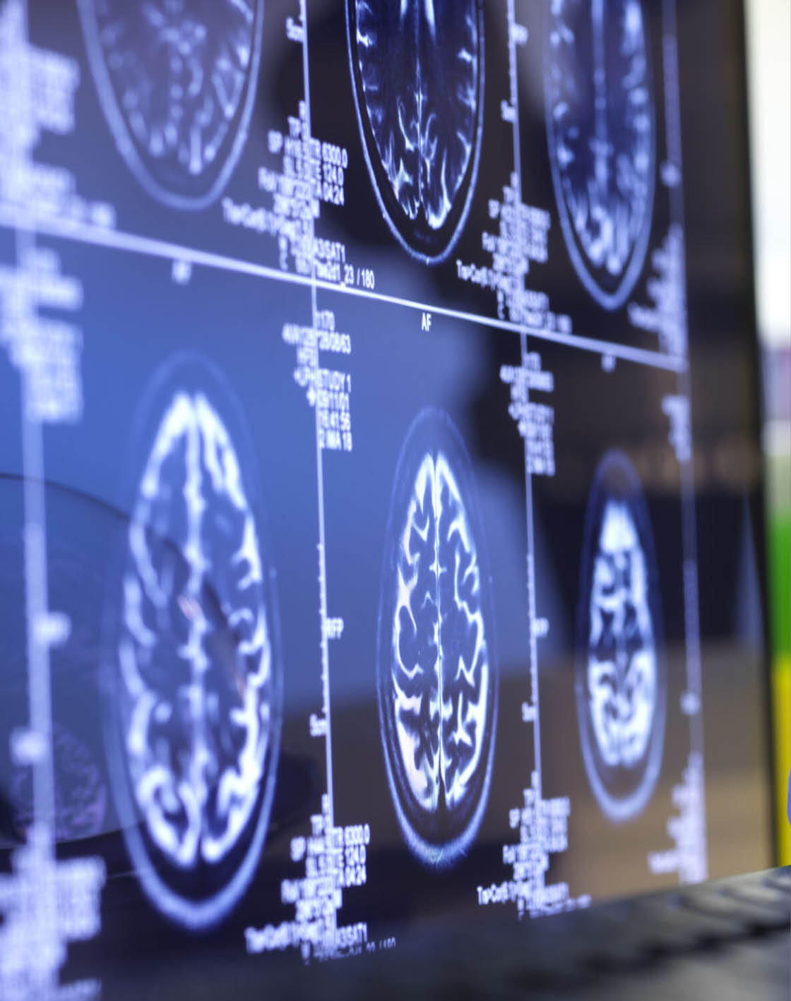 A laptop screen displays a mammogram image. AI generated content